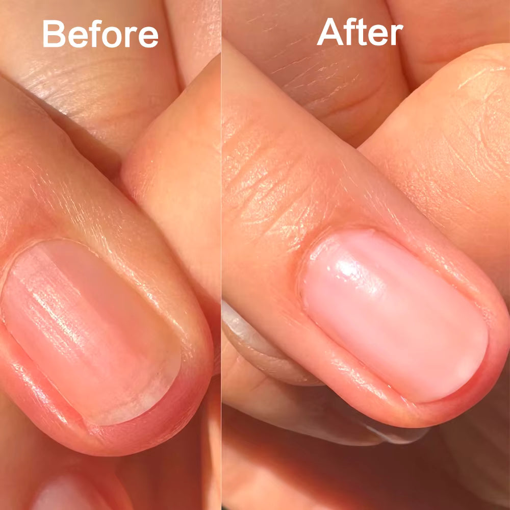 Lovcarrie Ridge Filler Base Coat for Smooth Nails 15ml