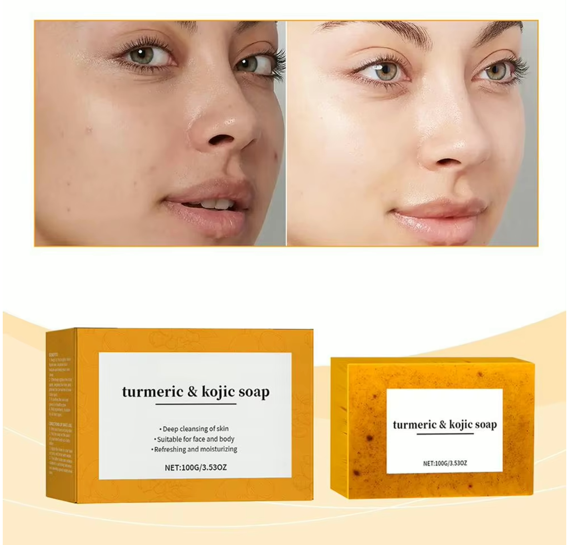 Turmeric and Kojic Soap Bar 100g